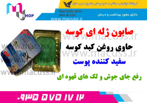 %d8%b5%d8%a7%d8%a8%d9%88%d9%86-%da%98%d9%84%d9%87-%d8%a7%db%8c-%da%a9%d9%88%d8%b3%d9%87