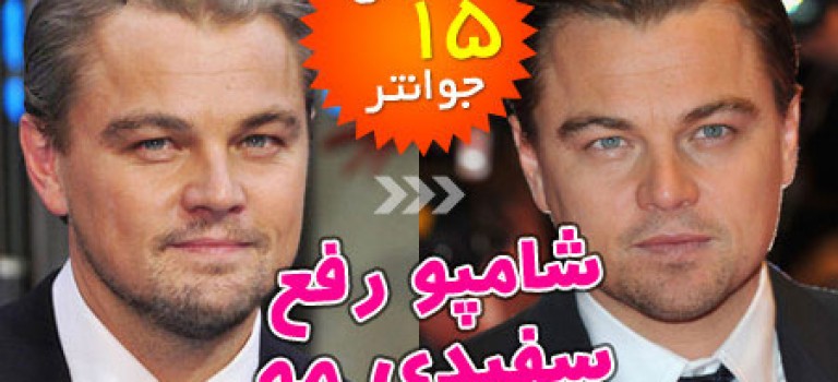 شامپوی رفع سفيدي مو