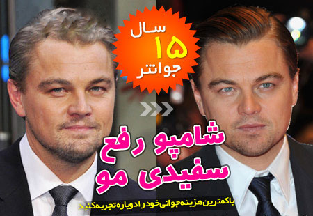 شامپو رفع سفیدی مو